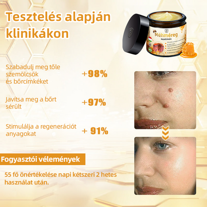 𝑇𝑢𝑟𝑜𝑛𝑢™ Méhpempő Bőrkezelő Krém (NNK Ajánlott)👨‍⚕️