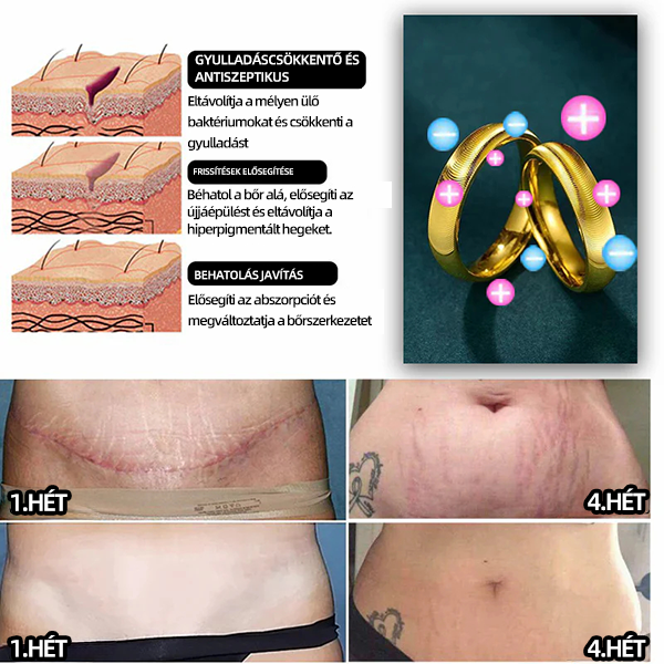 (🔥UTOLSÓ NAP AKCIÓ - 80% KEDVEZMÉNY) 𝐶𝑍𝑇𝐼𝐶𝐿𝐸™ 🔥Nyirok-mágneses terápia macskaszem gyűrű🎄