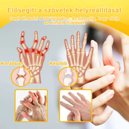 FATONG™ Méhméreg Fájdalomcsillapító Csontgyógyító Krém 🐝🐝🌿🌿 (Kifejezetten idősek számára & az AIPM ajánlja)🔥🔥
